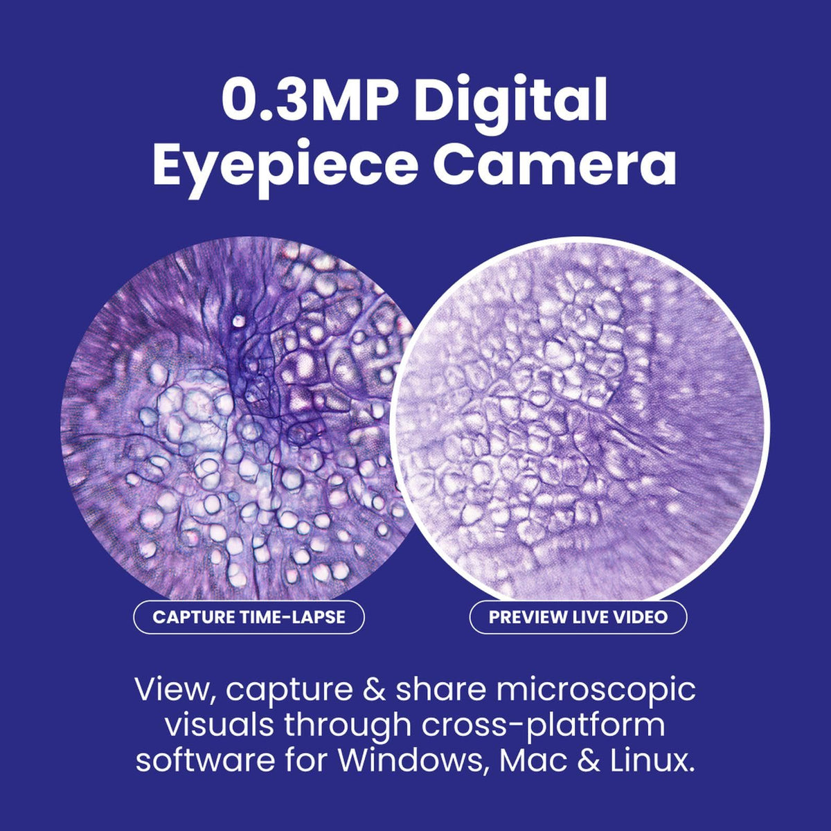 AmScope B120 Series Student & Professional LED Binocular Compound Microscope - 40X-2500X Magnification - Includes 0.3MP USB 2.0 Camera & Siedentopf Head