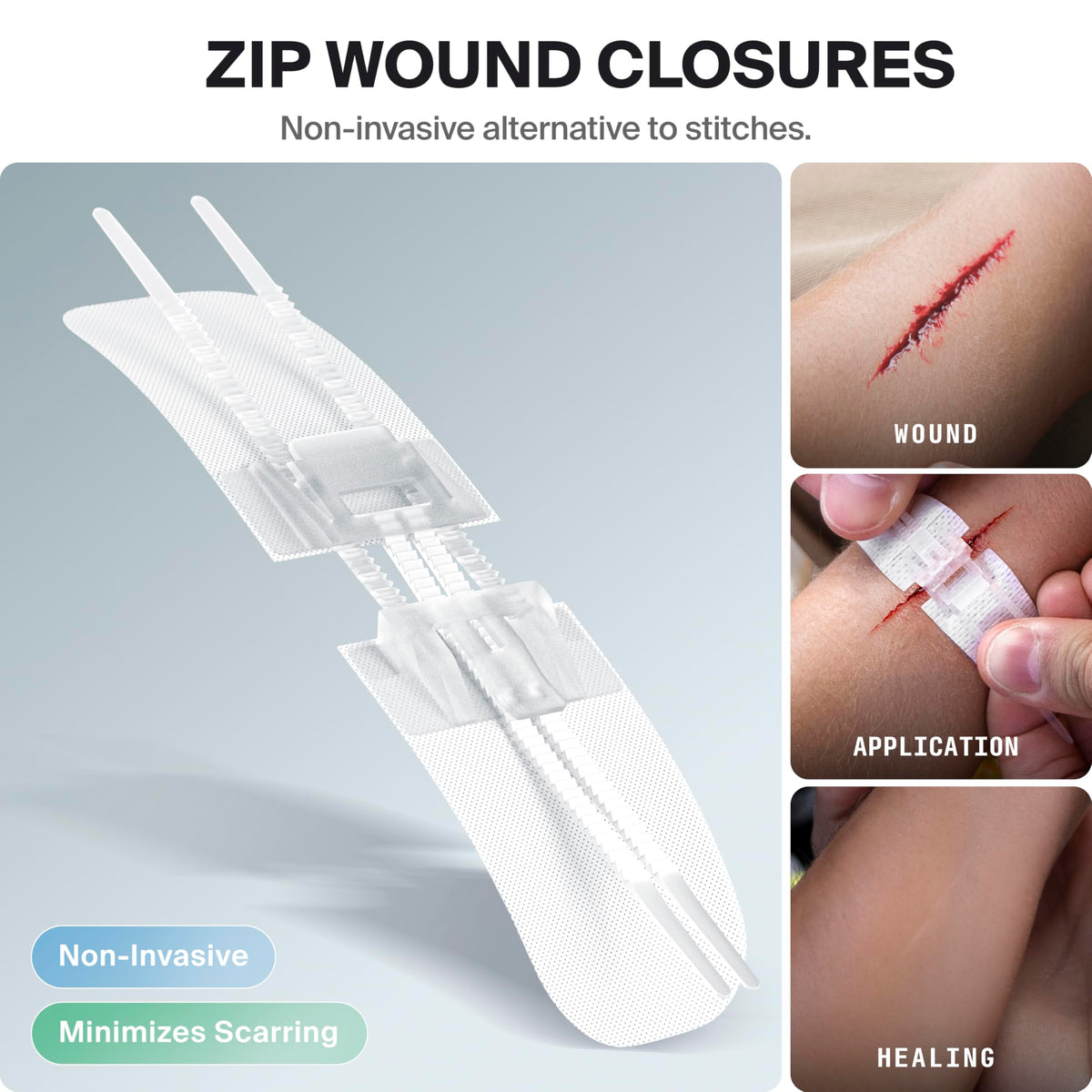 SurviveX Large Waterproof First Aid Kit for Car, Travel & Home - Emergency Kit for Hiking, Camping, Backpacking and Outdoors - Includes Zip Stitch Wound Closure Strips